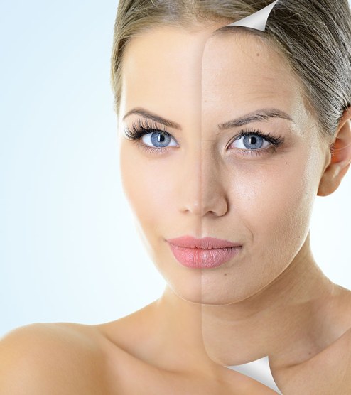 Gesichtslifting mit Langzeitwirkung Hautstraffung ist keine Laserbehandlung. Sie kann daher auch problemlos im Sommer durchgeführt werden. Nach der Behandlung dürfen Sie an die Sonne gehen.