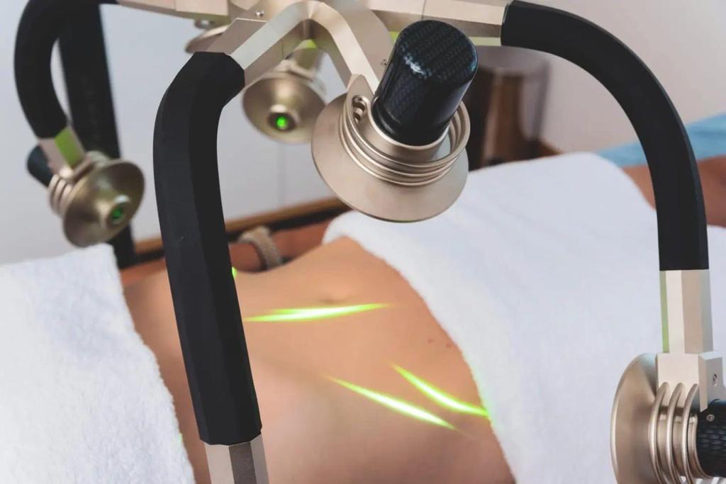 Zerona Lipo Laser für Cellulite und Fettverbrennung